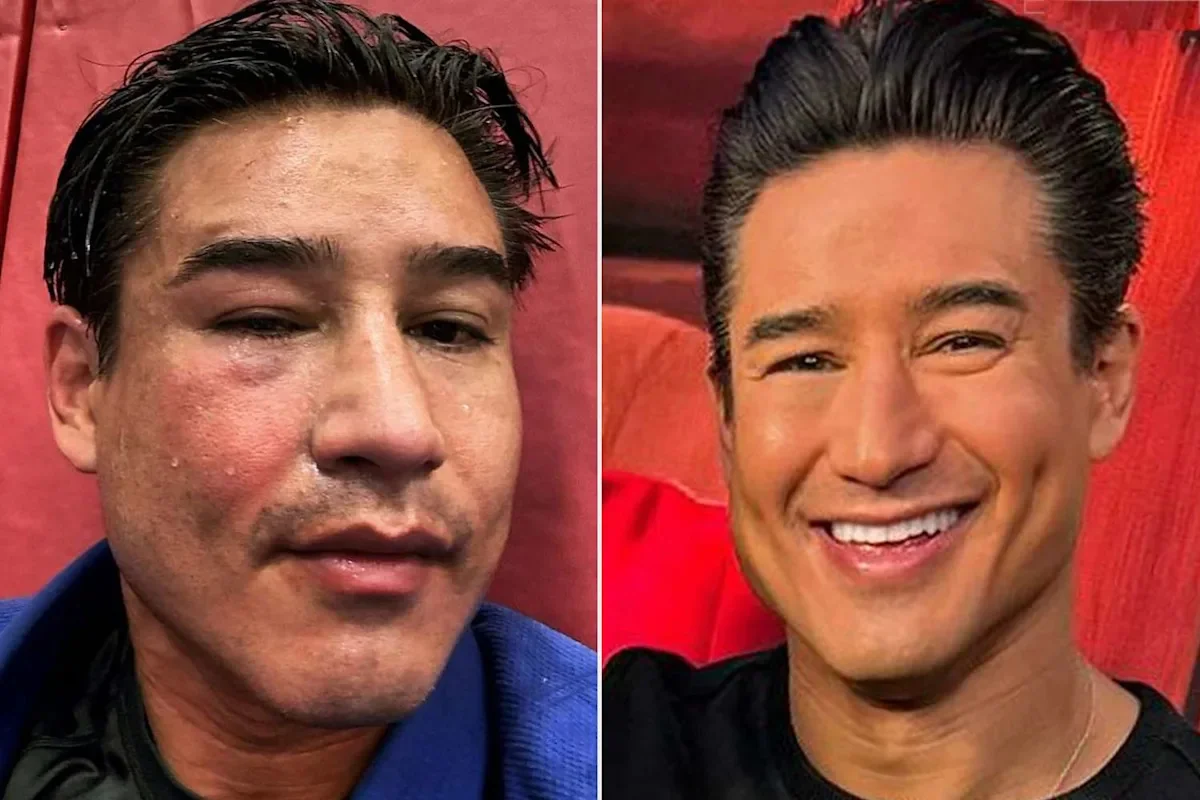 Mario Lopez TV host before and after injury recovery.